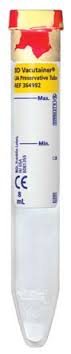 Bd Vacutainer® Urinalysis Tube with Chlorhexidine Ethyl Paraben Sodium Propionate Additive - BeHope