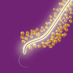 Absorbable Antibacterial Suture with Precision Reverse Cutting Needle Vicryl™ Plus - BeHope