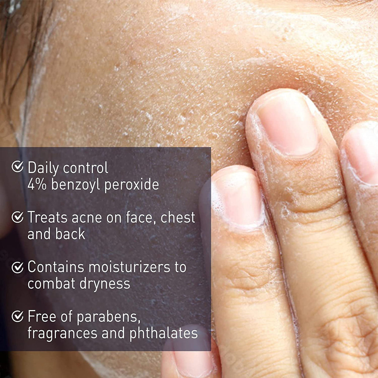 Acne Treatment PanOxyl 6 oz. Cream