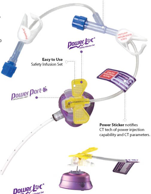 Huber Powerloc® Infusion Set Without Injection Port - BeHope
