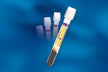 Bd Vacutainer® PPT™ Molecular Diagnostic Tube K2 EDTA Separator Gel Hemogard™ Closure - BeHope