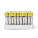 Bd Vacutainer® Urinalysis Tube with Preservative Hemogard™ Closure - BeHope