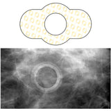 Radiolucent Radiology Skin Marker Spee-d-ring™ MLO Dense Breast Tissue - BeHope