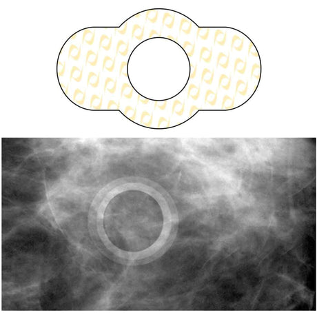 Radiology Skin Marker Spee-D-Ring™ Printed Circle Mole - BeHope
