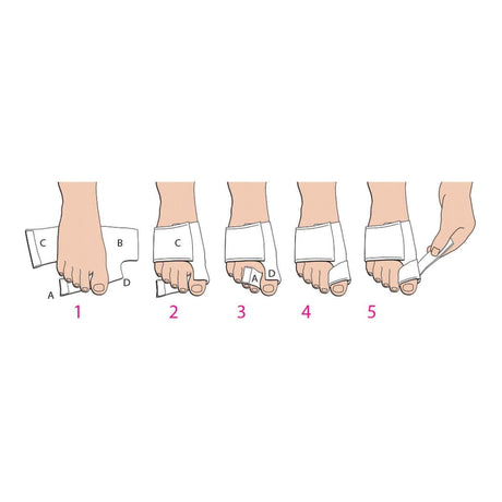 Bunion Splint Softsplint™ Small Left Foot - BeHope