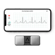 Electrocardiograph KardiaMobile® USB Connection Smart Phone Display Resting - BeHope