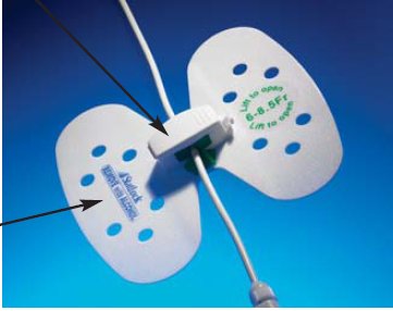 Catheter / Line Securement Device Statlock® Universal - BeHope