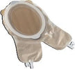 Fistula And Wound Management System