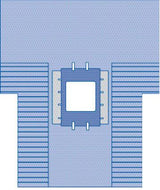 Bariatric Surgical Drape with Pouches