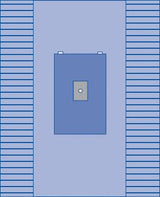 Sterile Minor Extremity Surgical Pack, Sirus - BeHope