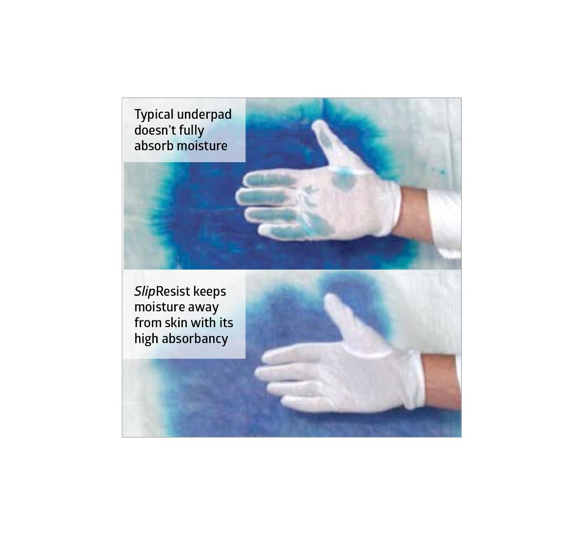 Ultrasorbs Advanced Premium Underpads