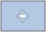 Medline Nonsterile Minor Procedure Drapes