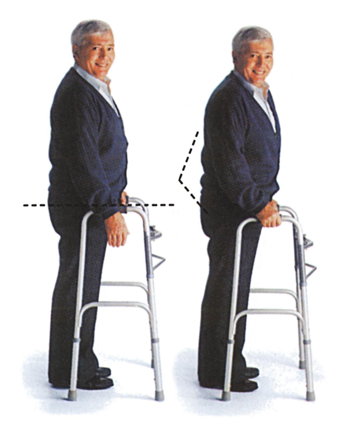 Medline Two-Button Folding Walkers without Wheels
