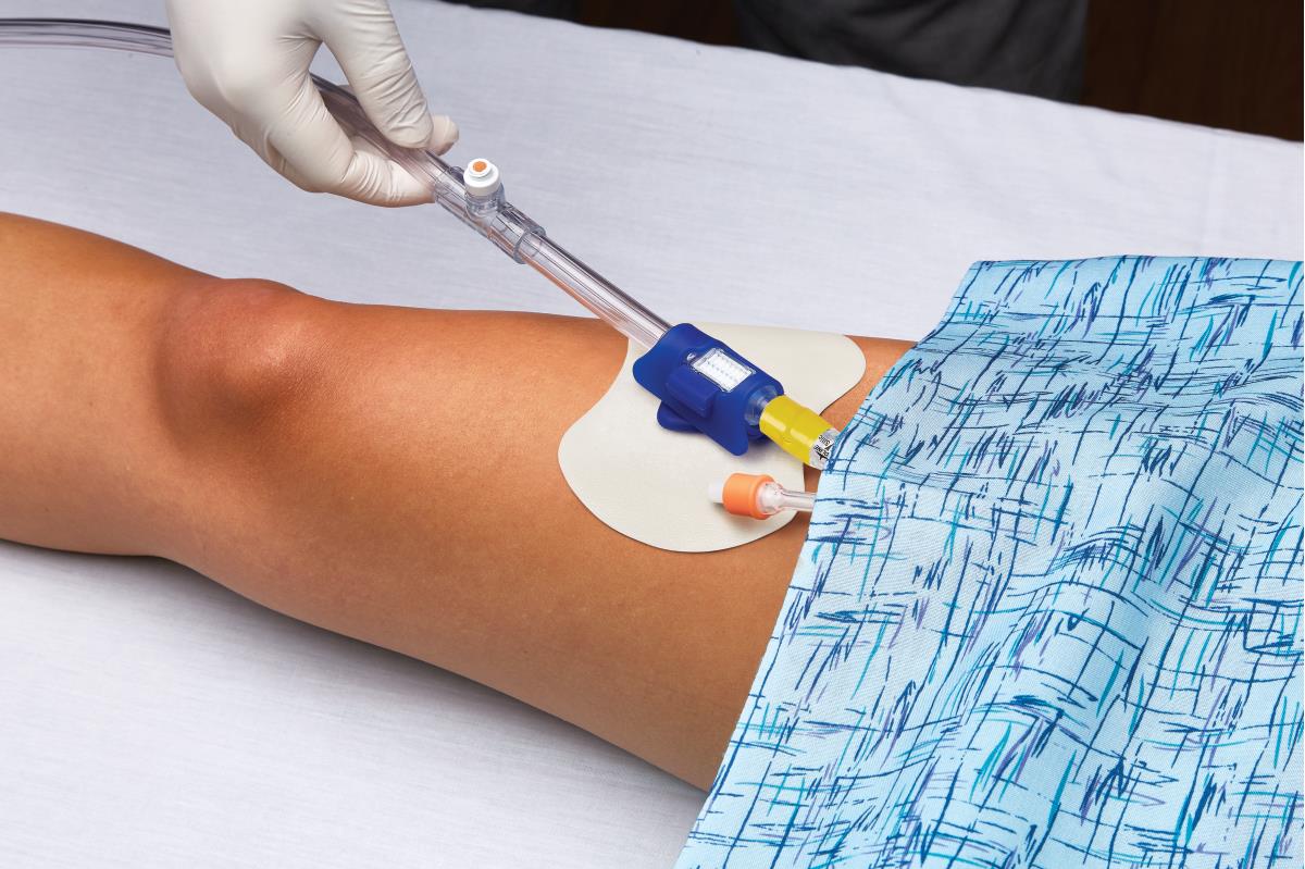 Safesecure Foley Catheter Securement Device - BeHope
