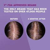 Women's Rogaine 2% Minoxidil Solution - BeHope