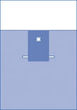 Neonatal Surgical Drape - BeHope