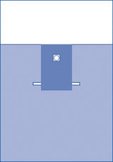 Neonatal Surgical Drape - BeHope