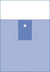 Neonatal Surgical Drape - BeHope