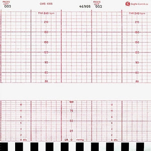 Recording Chart Paper Corometrics® Z-fold Red Grid - BeHope