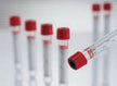 Vacuette® Venous Blood Collection Tube Serum Clot Activator Pull Cap - BeHope