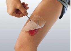 Cuticerin Sterile Low-Adherent Surgical Dressing - BeHope