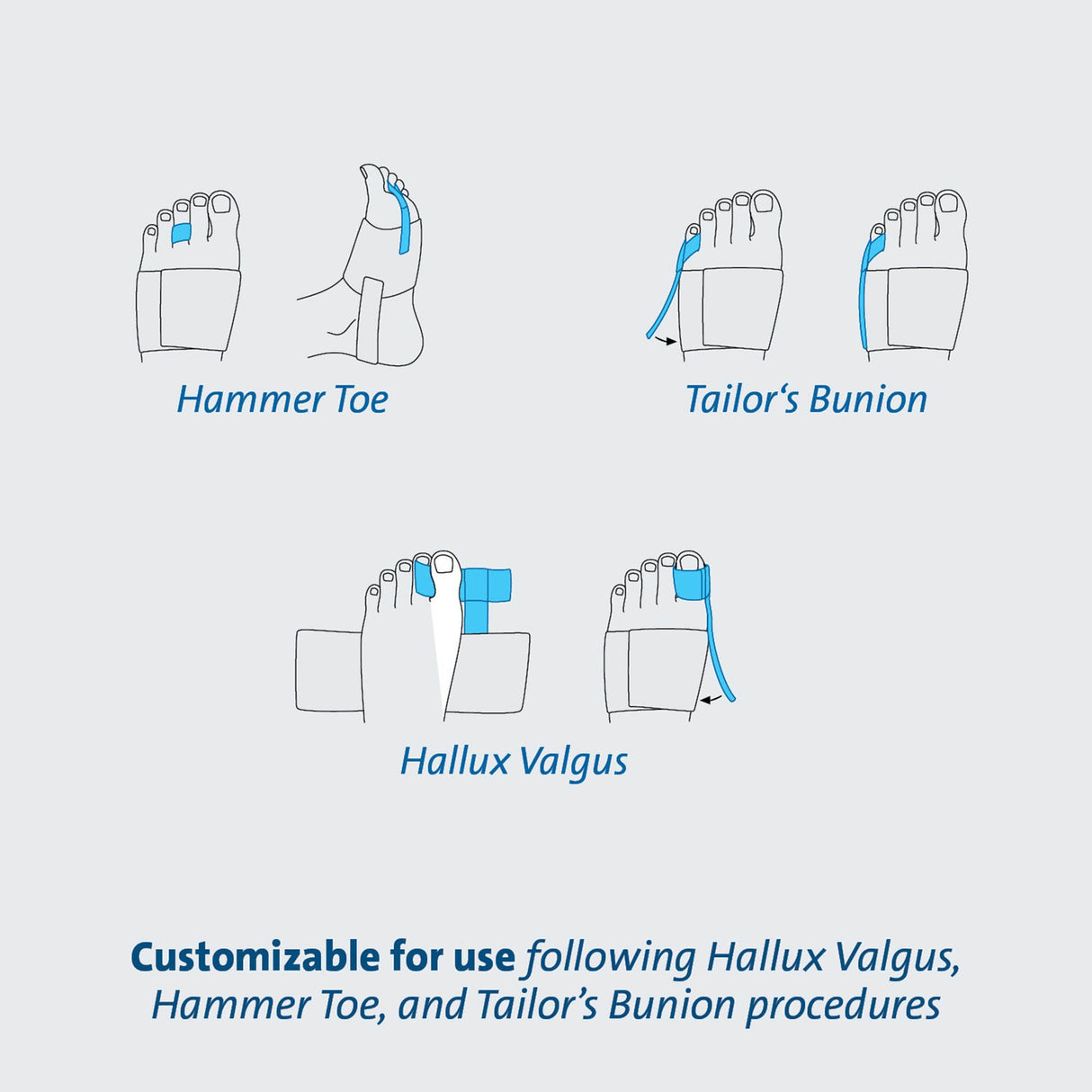 Toe Splint TAS™ One Size Fits Most Strap Closure Foot - BeHope