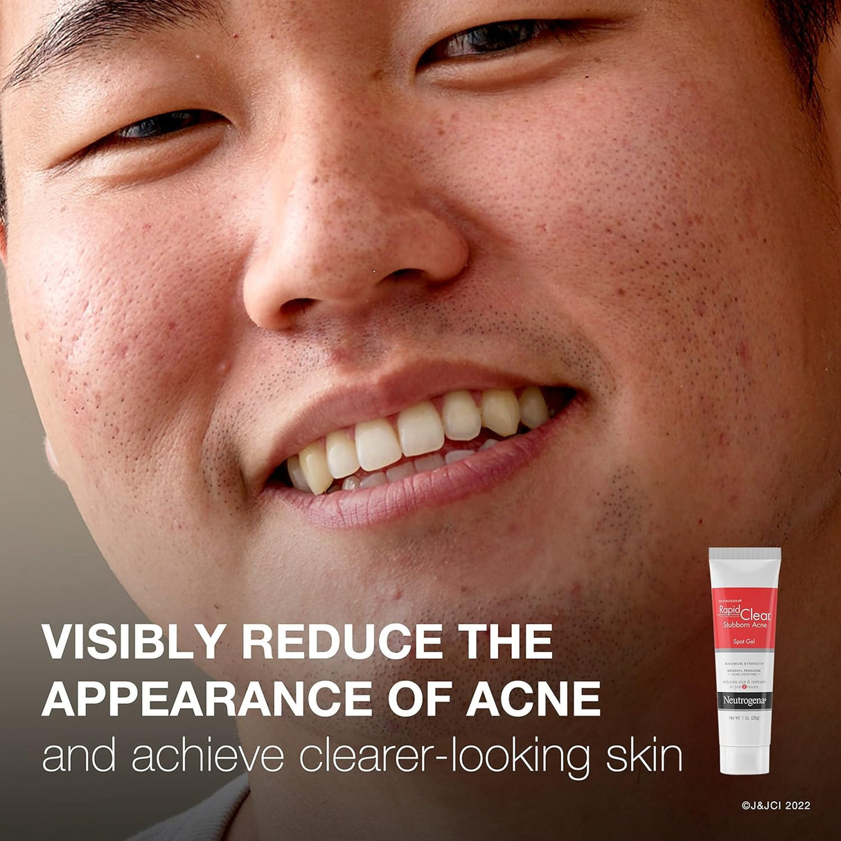 Acne Treatment Neutrogena® Rapid Clear 1 oz. Gel - BeHope