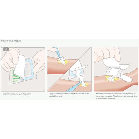Sodium Chloride Impregnated Dressing Mesalt® Ribbon 3/4 X 39 Inch Sterile - BeHope