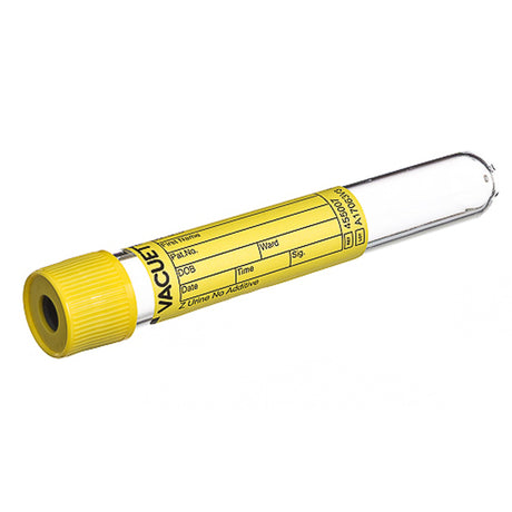 VACUETTE® Z Urine No Additive Urinalysis Tube Plain 10.5 mL Pull Cap Polyethylene Terephthalate (PET) Tube - BeHope
