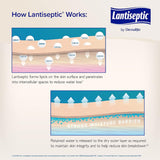 Skin Protectant Lantiseptic Dry Skin Therapy 14 oz. Jar Lanolin Scent Cream