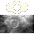 Radiology Skin Marker Spee-D-Ring™ - BeHope