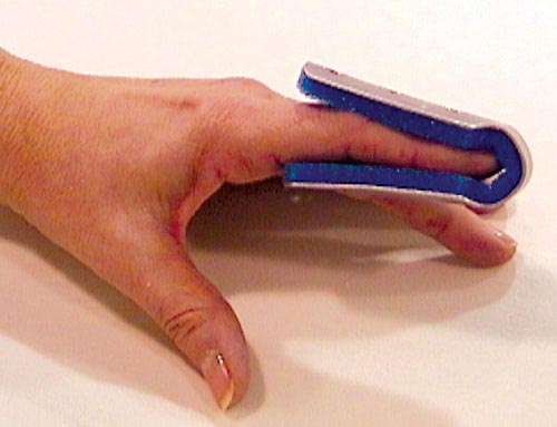 Attelle de doigt repliable, grande taille, en vrac, paquet de 6, non destinée à la vente au détail