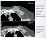 Radiology Skin Marker D-spot® Arrow Simulation - Behope