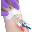 Catheter / Line Securement Device Grip-lok® - Behope
