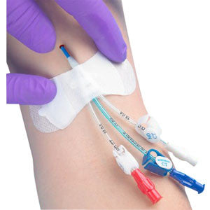 Catheter / Line Securement Device Grip-lok® - Behope